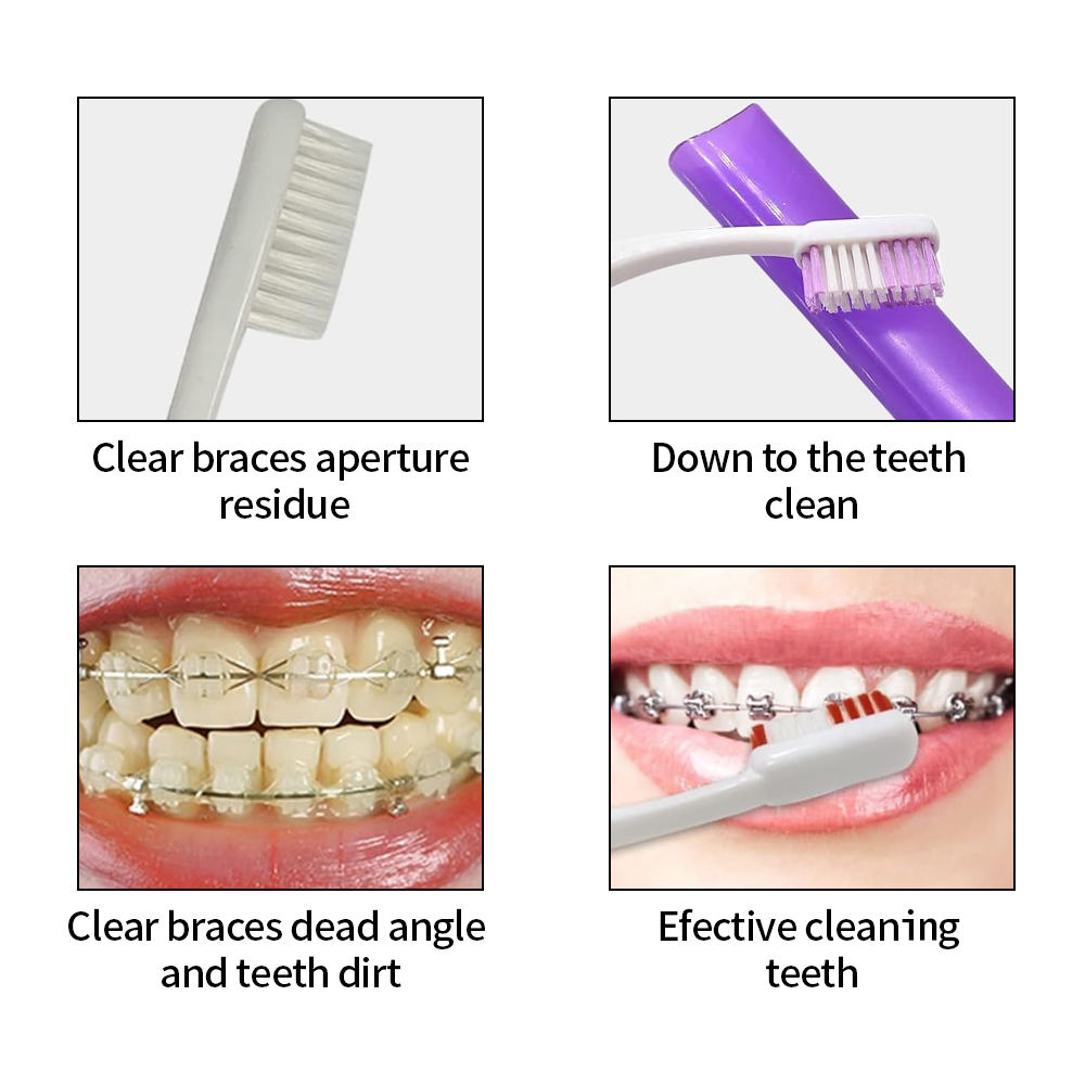 8Pcs/set Orthodontic Dental Ca - Teeth Whitening With Braces 评论和价格