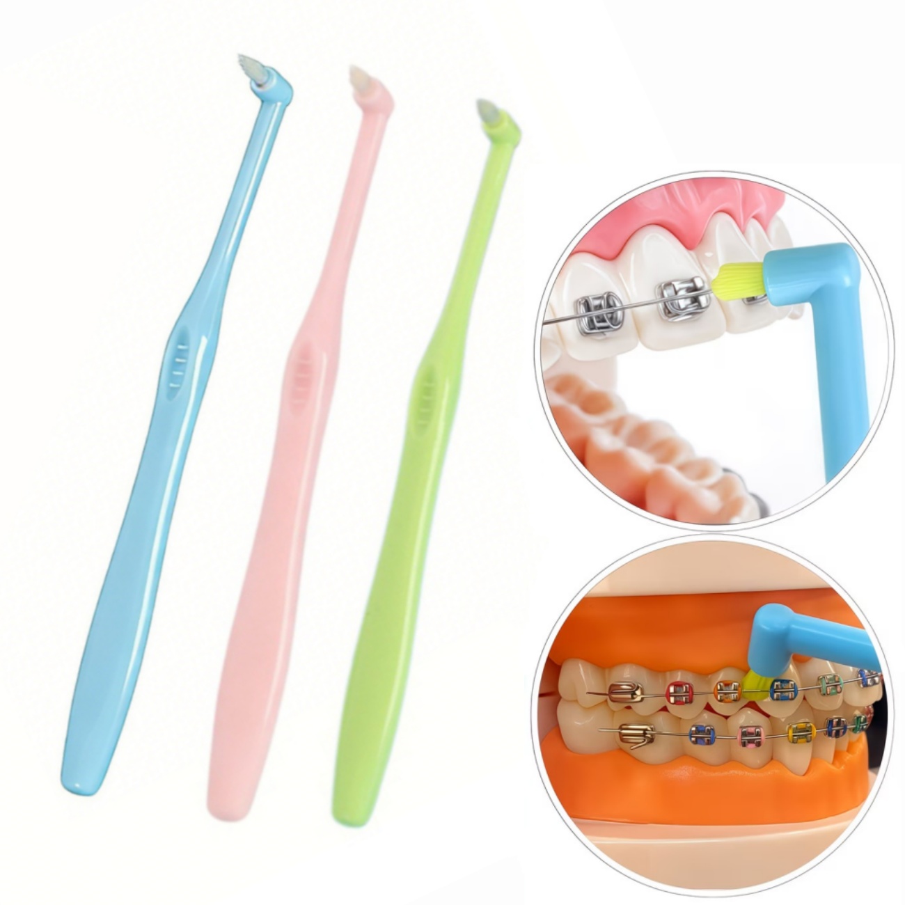 1/3pc Orthodontic Braces Tooth - Teeth Whitening With Braces 评论和价格