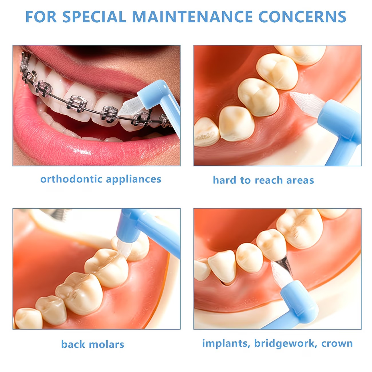 1/3pc Orthodontic Braces Tooth - Teeth Whitening With Braces 评论和价格