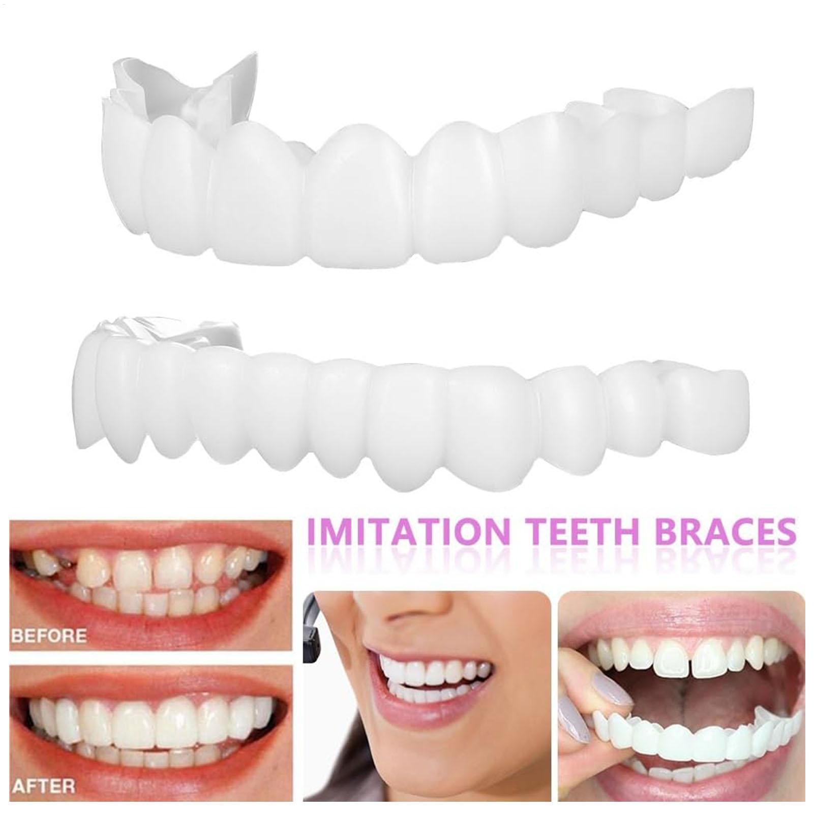 Dental Upper Lower Fake Teeth  - Teeth Whitening With Braces 评论和价格