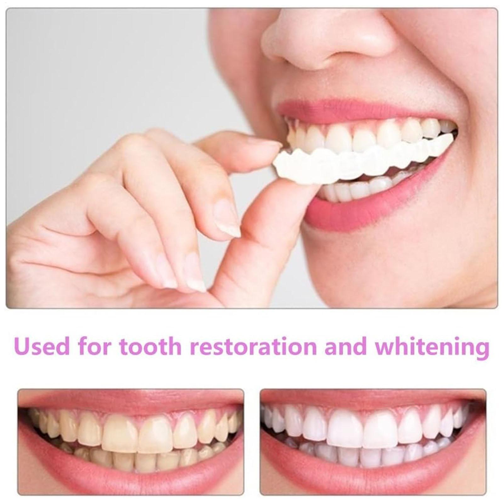 Dental Upper Lower Fake Teeth  - Teeth Whitening With Braces 评论和价格