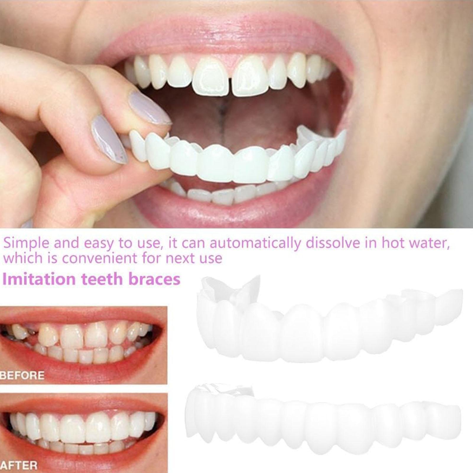 Dental Upper Lower Fake Teeth  - Teeth Whitening With Braces 评论和价格