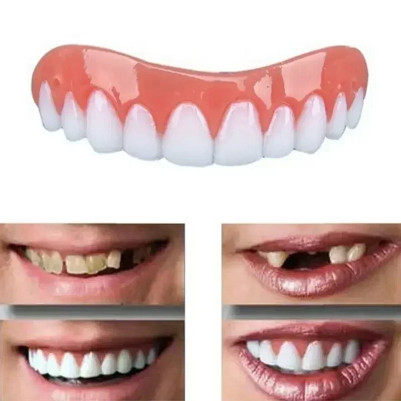 New False Teeth Silicone Upper - Teeth Whitening With Braces 评论和价格