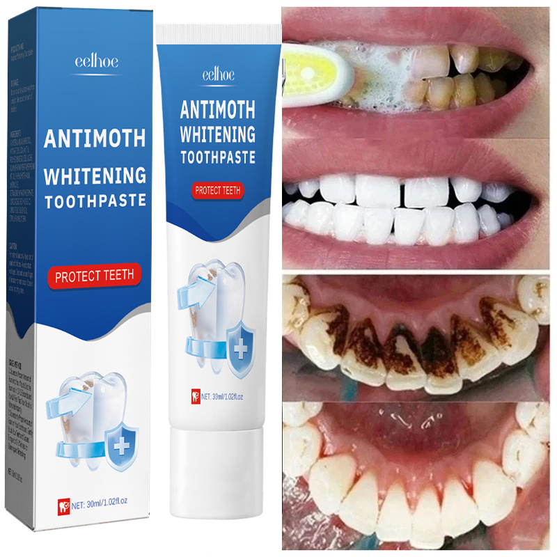 Fast Remove Smoke Stains Tooth - Teeth Whitening Fast 评论和价格