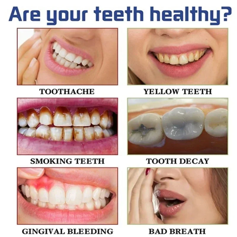 Fast Remove Smoke Stains Tooth - Teeth Whitening Fast 评论和价格