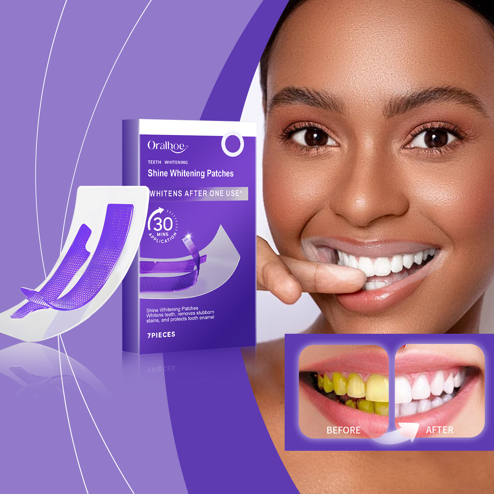 Purple Teeth Whitening Strips  - Teeth Whitening Strips Crest 评论和价格
