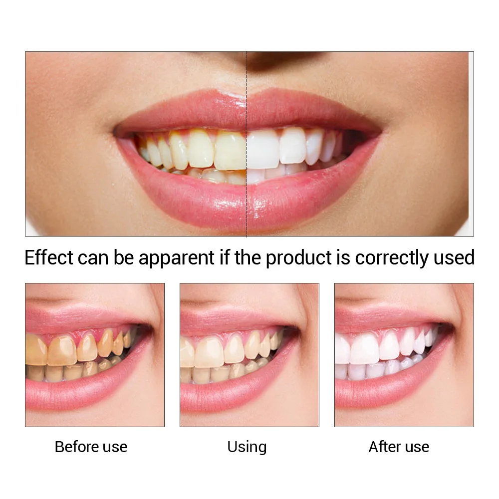 FTEENPLY Teeth Whitening Essen - Teeth Whitening Essence 评论和价格