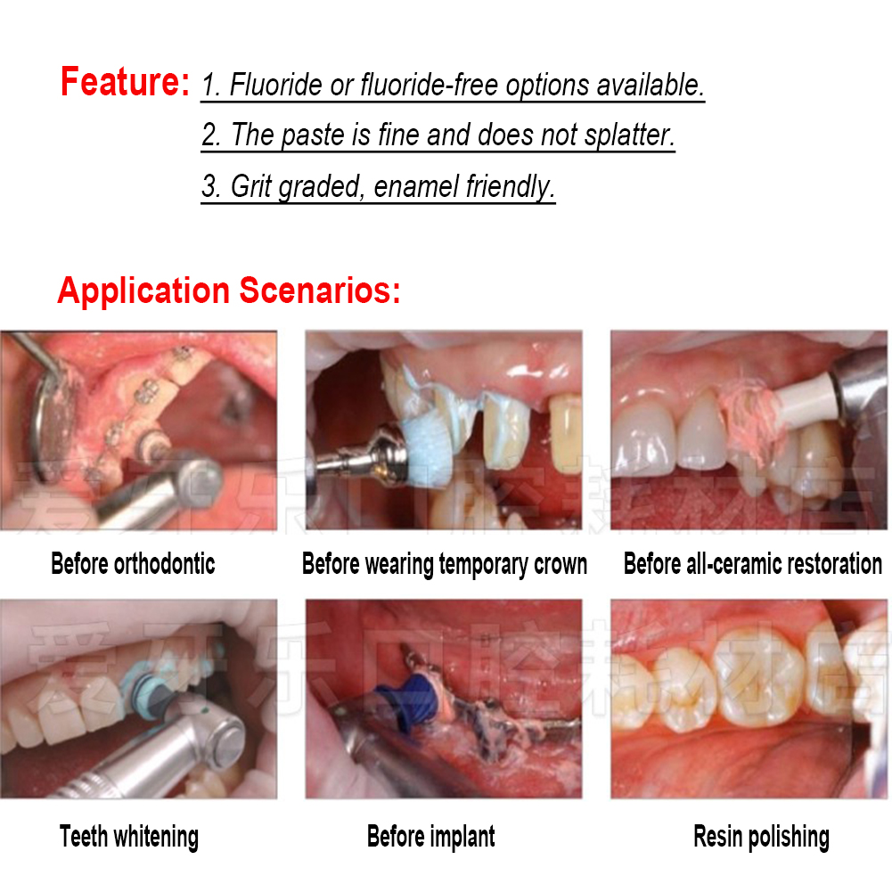 Ivoclar Vivadent Oral Teeth Po - Teeth Whitening Xylitol 评论和价格