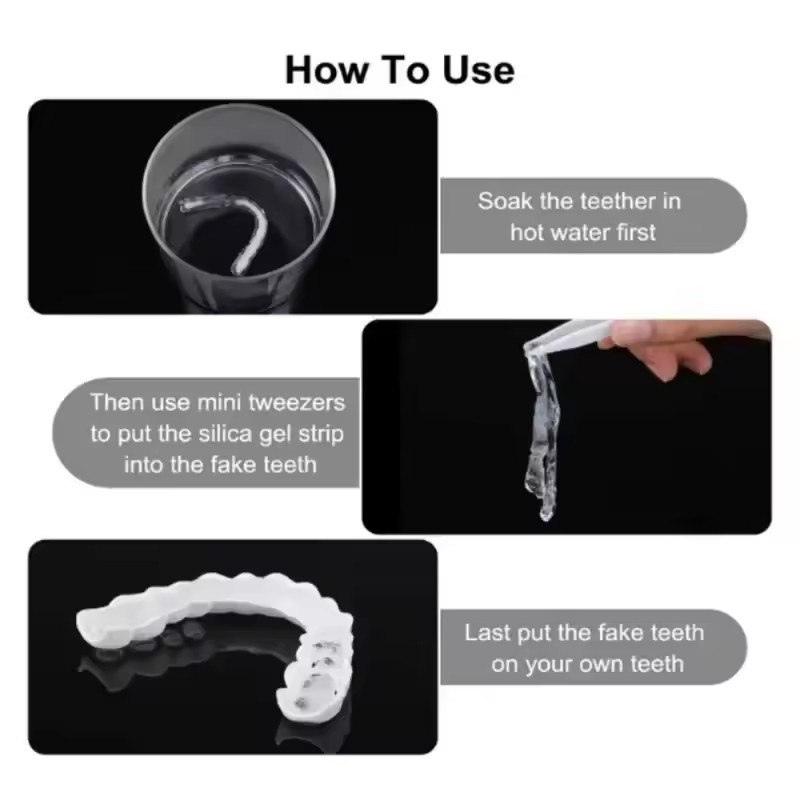 Teeth Veneers Whitening Dentur - Teeth Whitening With Braces 评论和价格