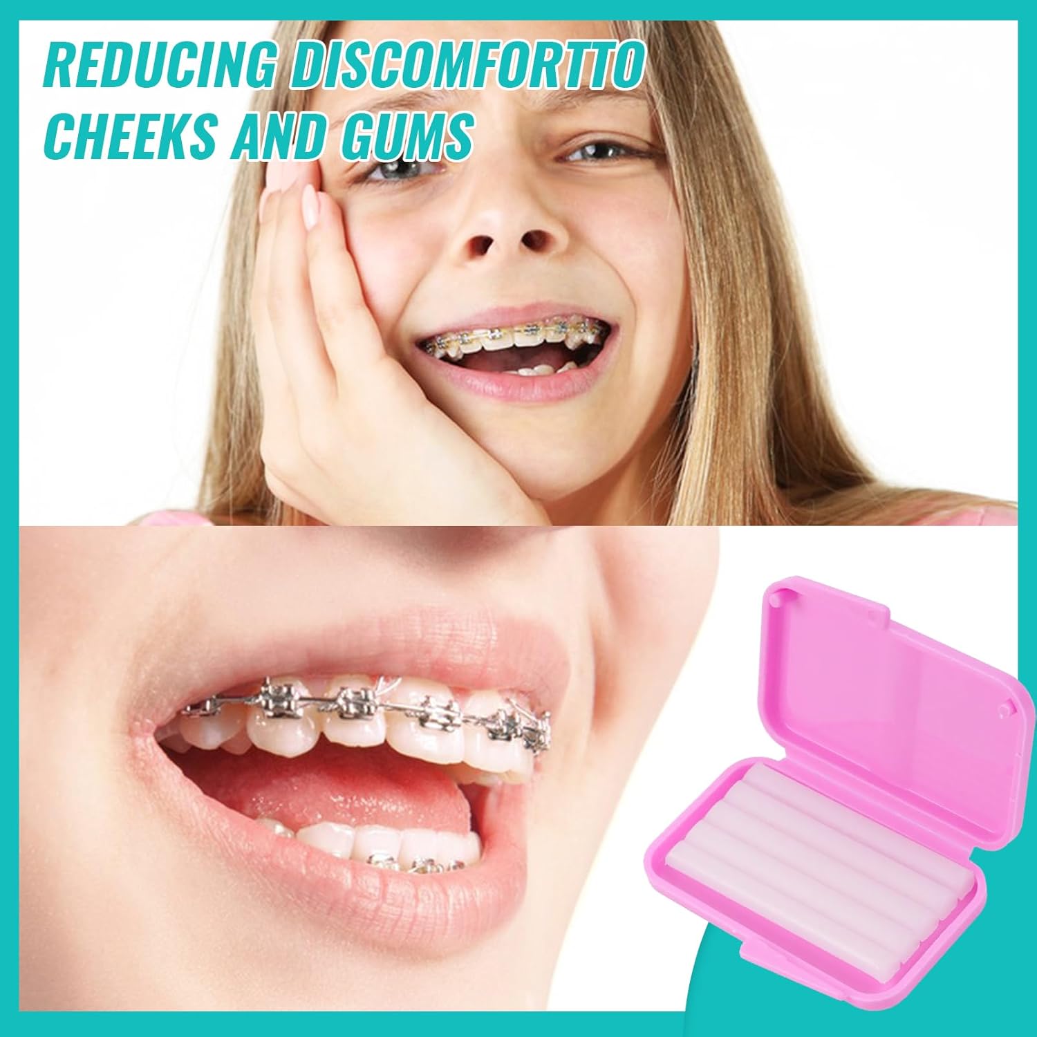 10box Dental Orthodontic Relie - Teeth Whitening With Braces 评论和价格