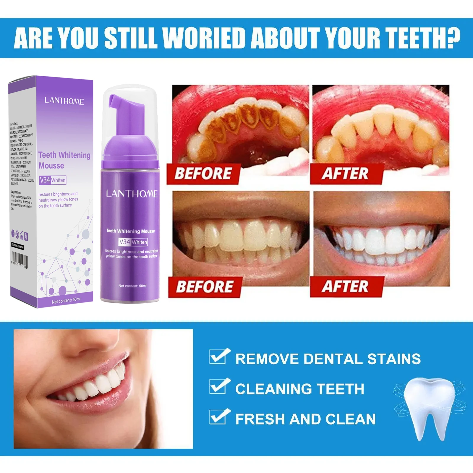 V34 Teeth Whitening Mousse Too - Teeth Whitening Xylitol 评论和价格
