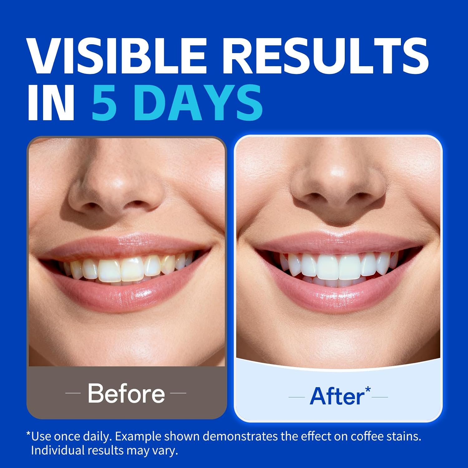 1/7 pairs Teeth Whitening Stri - Teeth Whitening Strips Crest 评论和价格