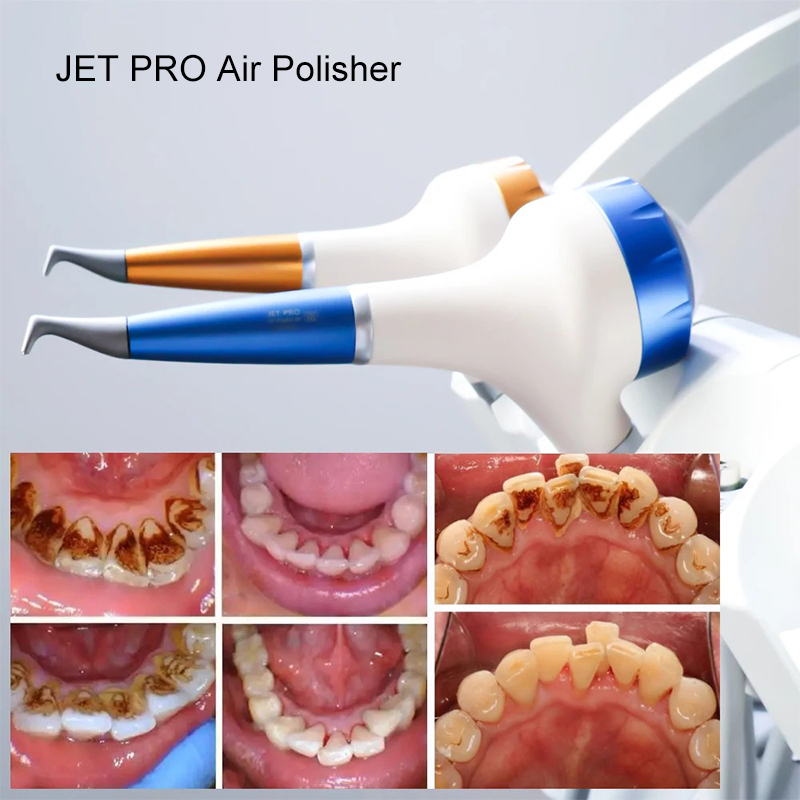 VV Dental  Air Polishing Proph - Teeth Whitening Free 评论和价格