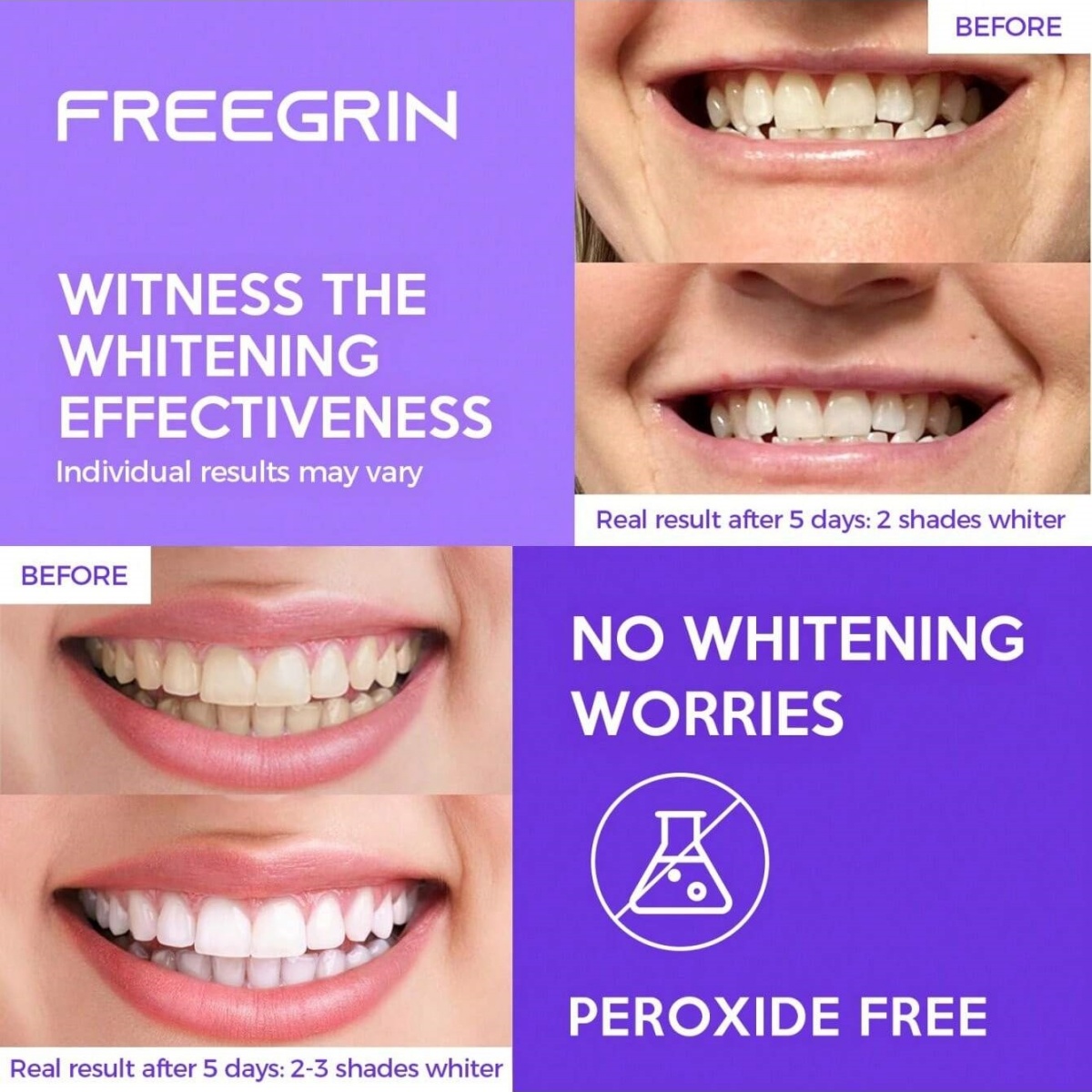 Deluxe Whitening Teeth Sticker - Teeth Whitening Gels Used By Dentists 评论和价格