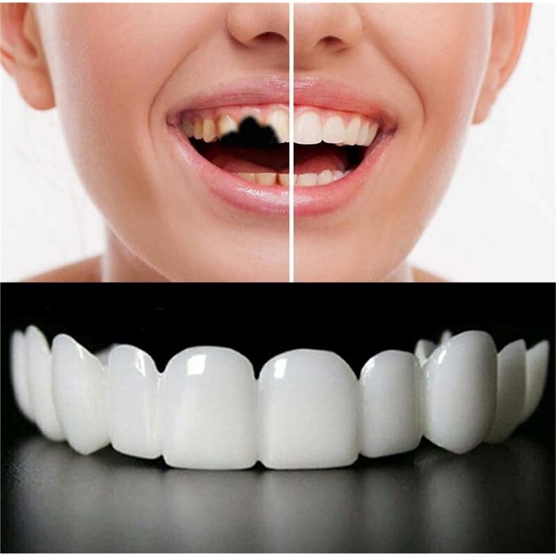 [NEW!ABMK】 2 Pairs,Regain Beau - Teeth Whitening With Braces 评论和价格