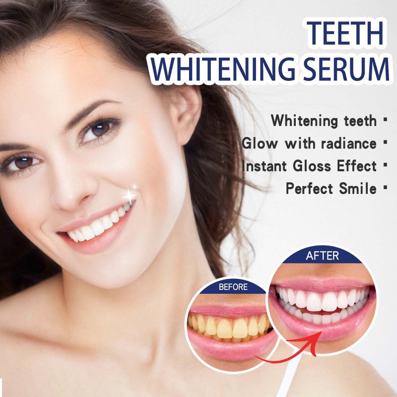 Professional Teeth Brightening - Teeth Whitening Serum 评论和价格